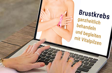 Frauenhände auf der Tastatur eines Laptops - auf dem Bildschirm ist eine Fachinformation zum Thema Brustkrebs zu sehen